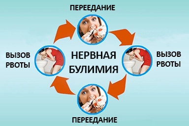 Лечение булимии в Ключах
